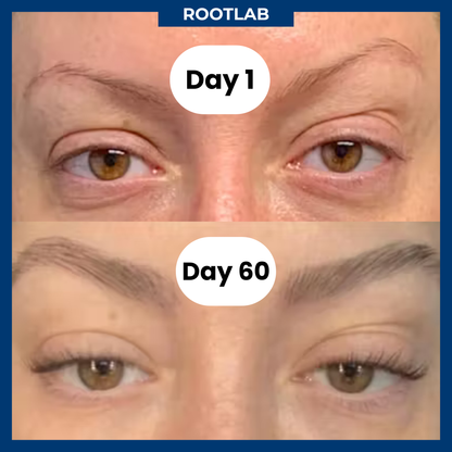 RootLab™ Brows Roll-On Growth Serum