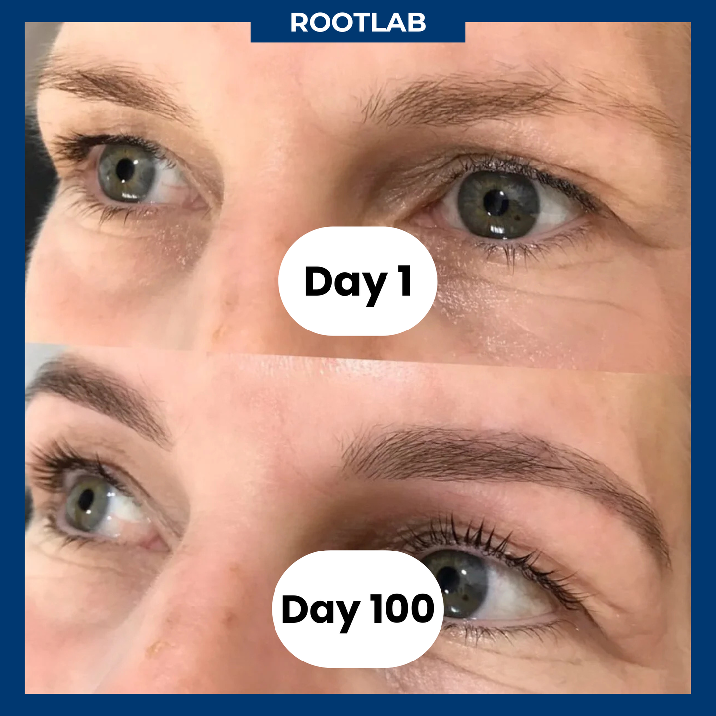RootLab™ Brows Roll-On Growth Serum